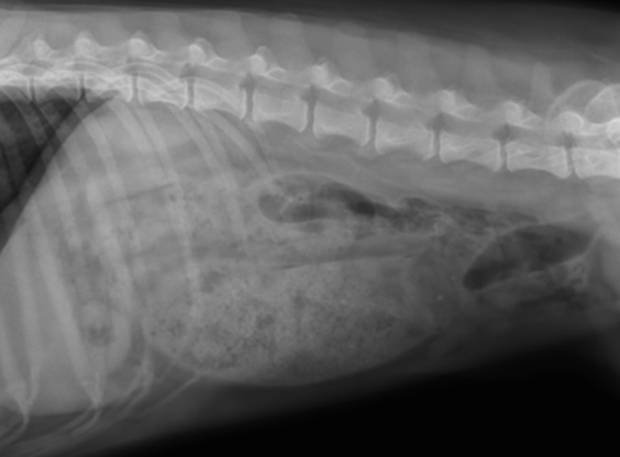 <p>-mass, FB, stricture</p><p>-pelvic fracture with narrowing of canal</p><p>-perineal hernia</p>