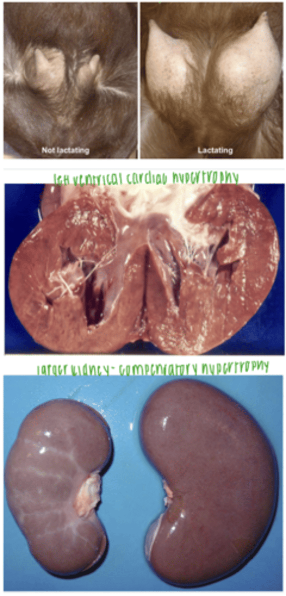 <p>1. specific hormonal stimulation (ex- during pregnancy, estrogen causes hypertrophy of the uterus)</p><p>2. higher functional requirements (ex- hypertrophy of the cardiac muscle due to chronic hemodynamic overload, bc of hypertension)</p><p>3. compensatory for loss of part of the organ or one of an even numbered organ (ex- one kidney fails so the other must work harder, leading to its hypertrophy)</p>