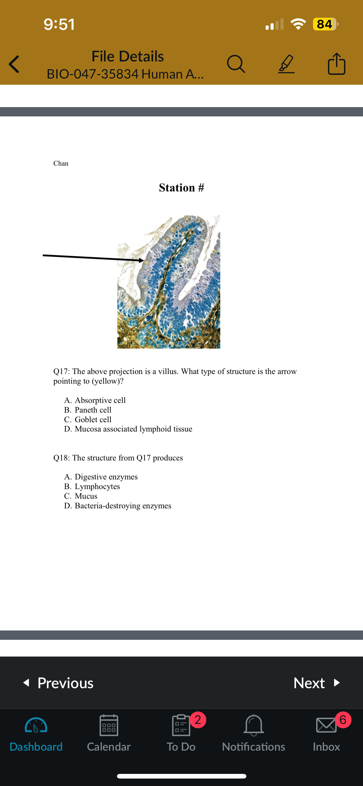 <p>Q17: The above projection is a villus. What type of structure is the arrow pointing to (yellow)?</p>