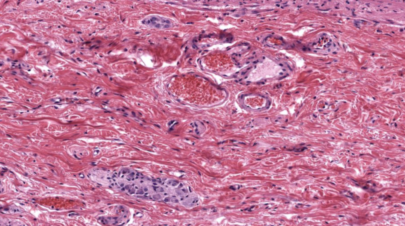 <p>Submucosa in Colon</p>