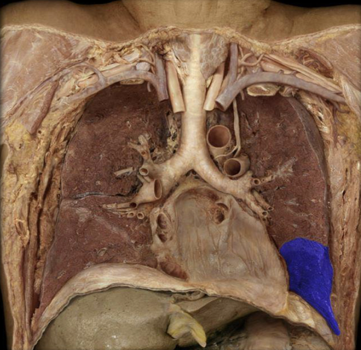 What structure is highlighted in blue?