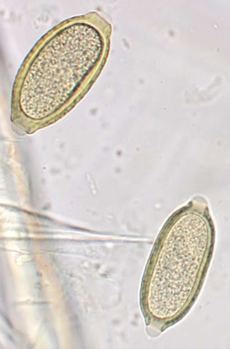 <p>The eggs in the accompanying image were seen on the fecal flotation of a beagle with occasional sneezing. The eggs measured approximately 65 um. What are these eggs?</p>
