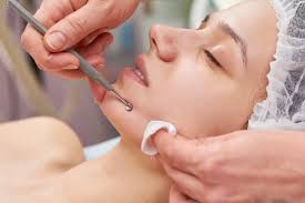 <p>Extractions </p>