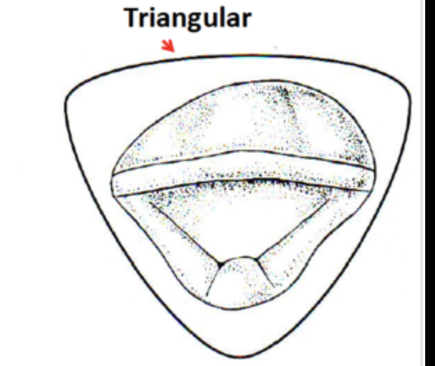 <p>triangular </p>