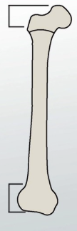 <p>what is this called? enlarged end of a long bone (both top and bottom)</p>