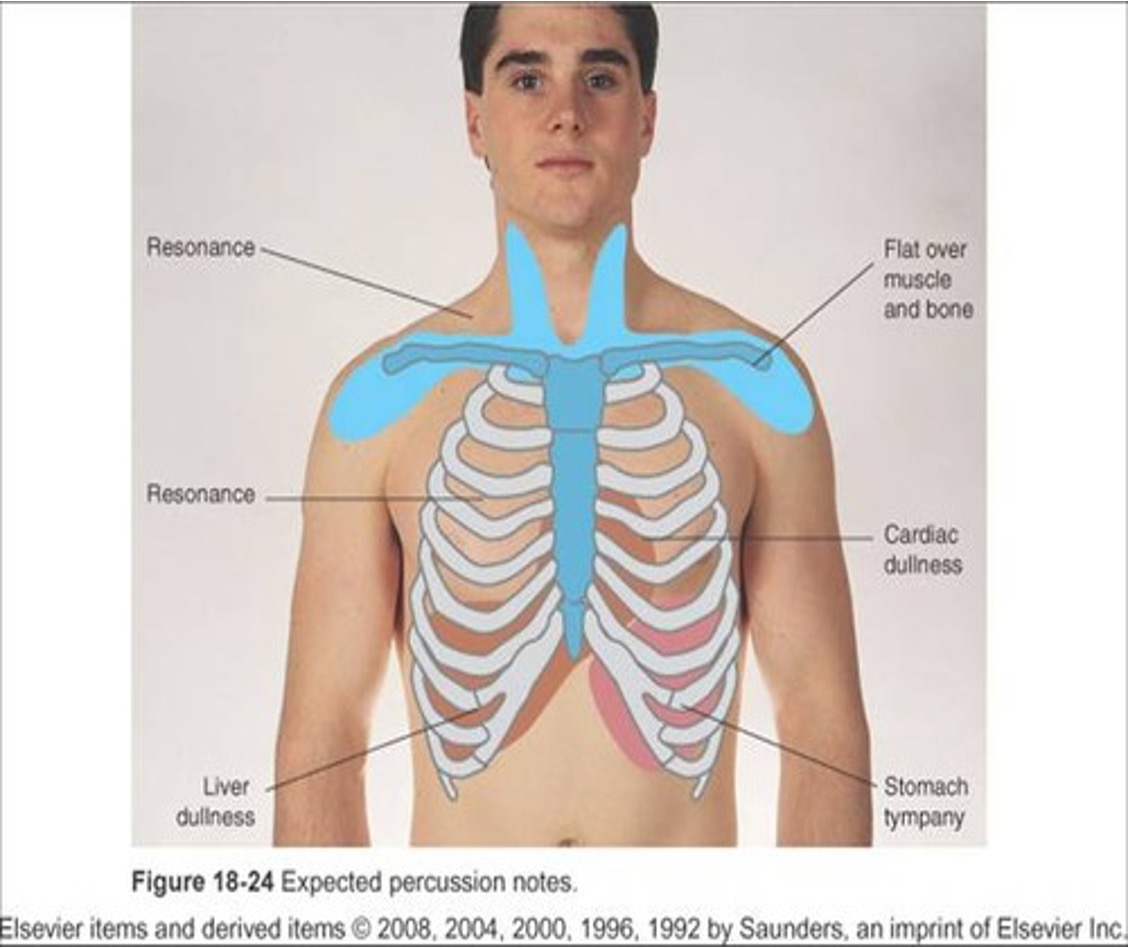 <p><span>•Begin percussing apices in supraclavicular areas</span></p><ul><li><p>perform bilateral comparison</p></li></ul><p><span>•Note borders of cardiac dullness normally found on anterior chest.</span></p><ul><li><p><span>•On right, upper border of liver dullness is located in fifth intercostal space in right midclavicular line.</span></p><p><span>•On left, </span><strong><em><u><span>tympany</span></u></em></strong><span> is evident over gastric space.</span></p></li></ul>