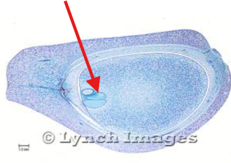 <p>What is being indicated on the Zamia Ovule?</p>