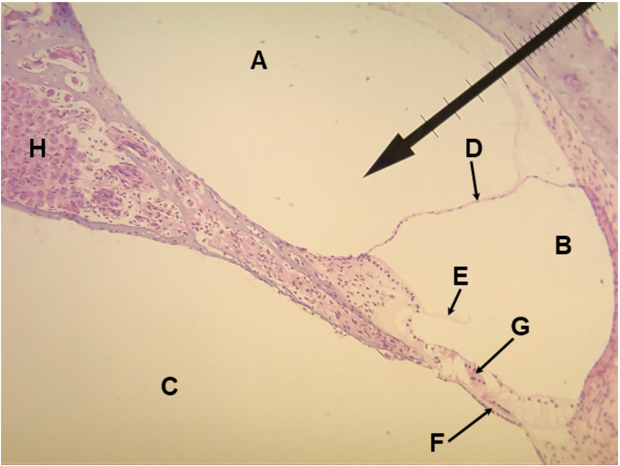 <p>In the image above, identify spaces A-C, and structures D-H.</p>