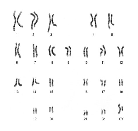<p><span>An ordered arrangement (from longest to shortest) of chromosomes as seen under the microscope</span></p><p><span>22 pairs of autosomes</span></p><p><span>1 pair of sex chromosomes</span></p>