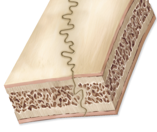 <p>What kind of joint can be found in this image?</p>