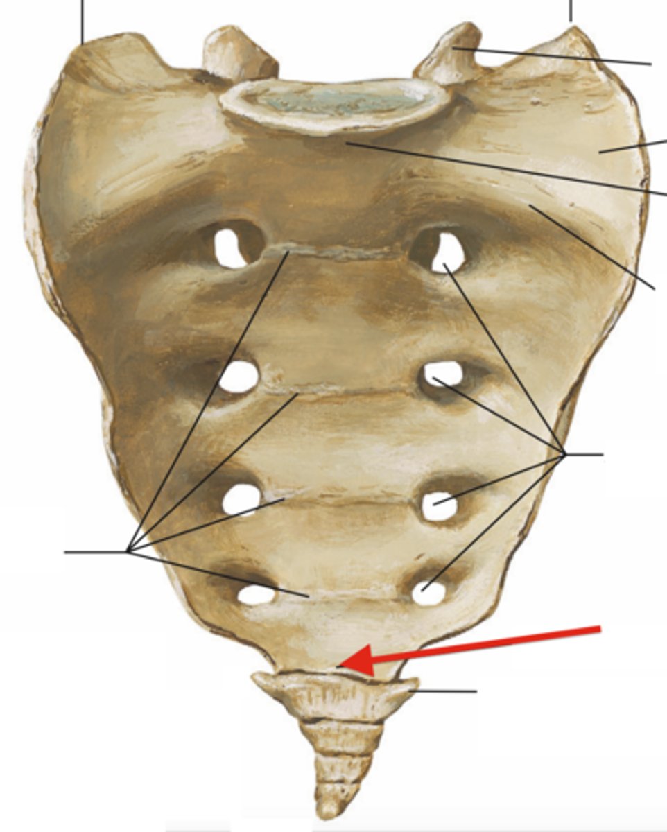 <p>(anterior)</p>