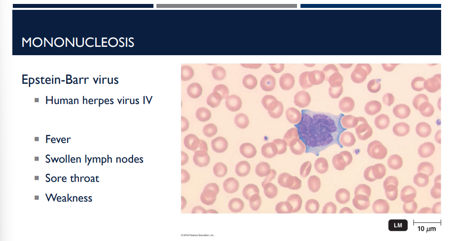 <p>What virus causes mononucleosis?</p>