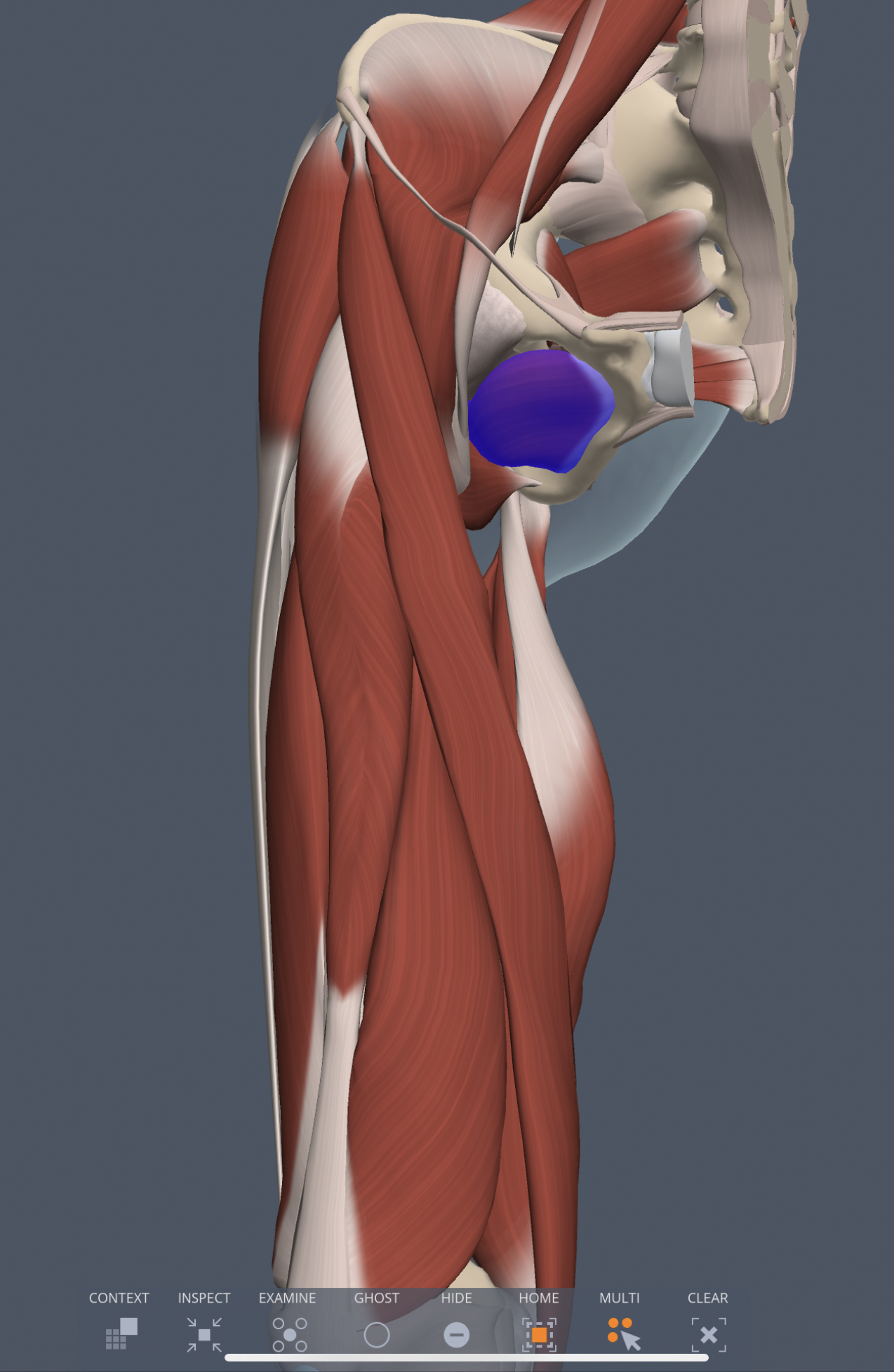 obturator externus (medial thigh) insertion
