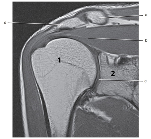 <p>What is # 2 ?</p>