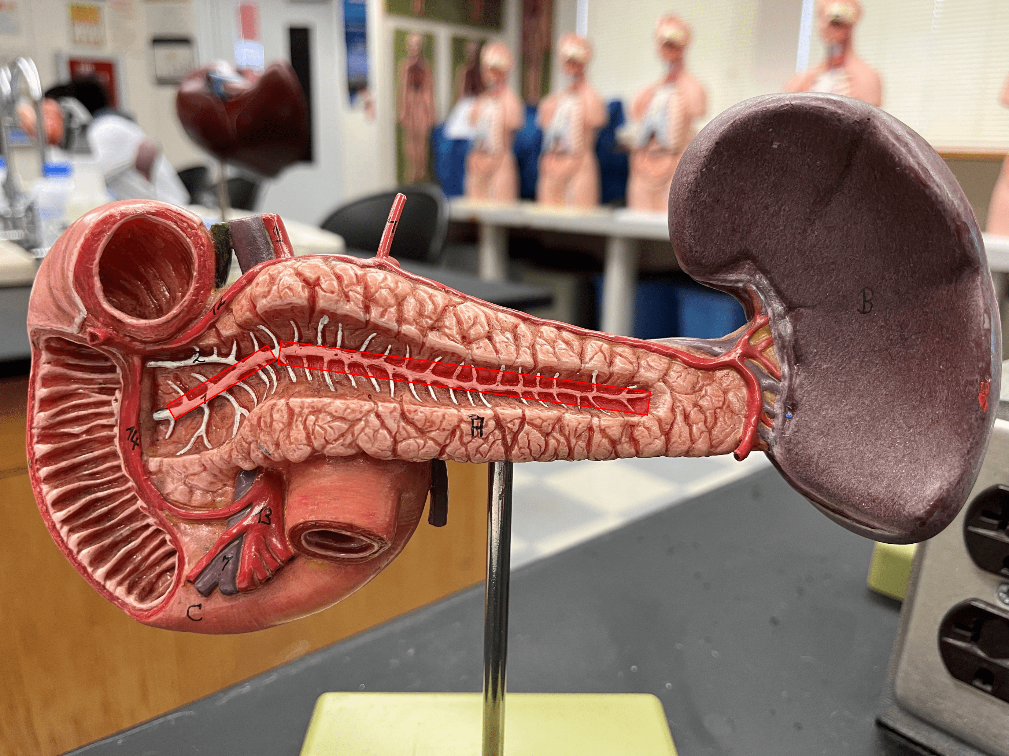 • A central duct extending from the tail to the head of the pancreas.

• Secretions from acinar cells travel by this duct.

• Joins the common bile duct to form the hepatopancreatic ampulla.

• Opens into the duodenum at the major duodenal papilla.