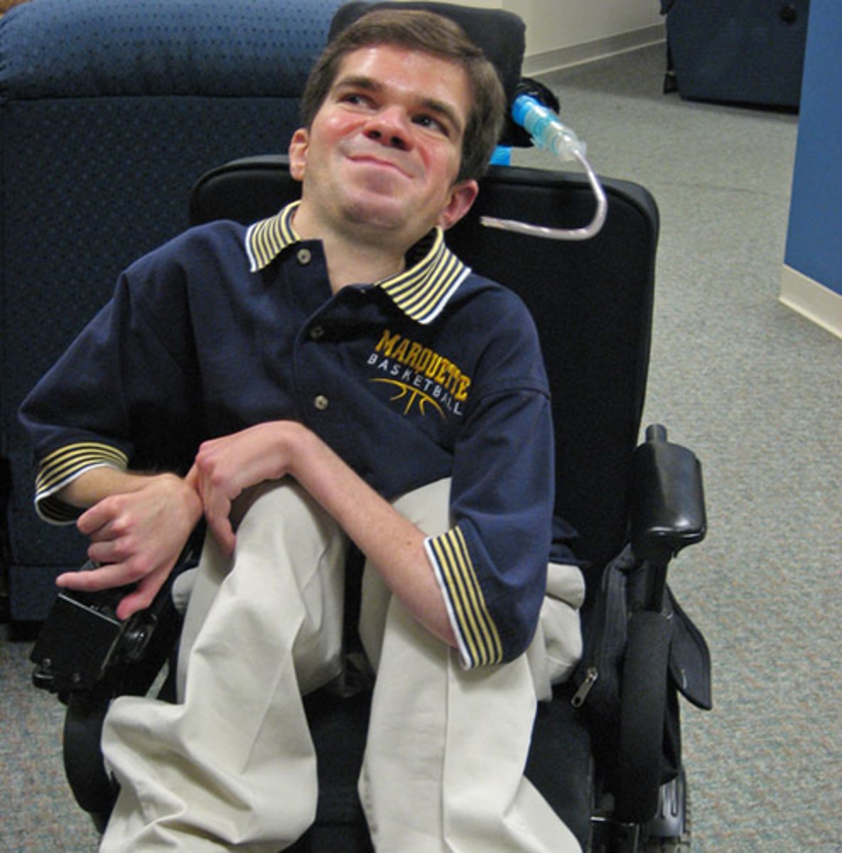 <p>X-linked disorder caused by the mutation of the protein dystrophin; no anchoring of actin to the sarcolemma</p>