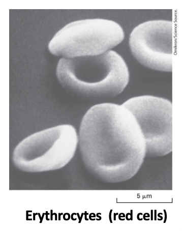 <p>discoid - flexible shape required for squeezing through blood capillaries with smaller diameters </p><p>shape defects cause cell lysis (anemias) </p>