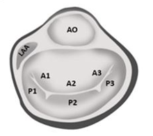 term image