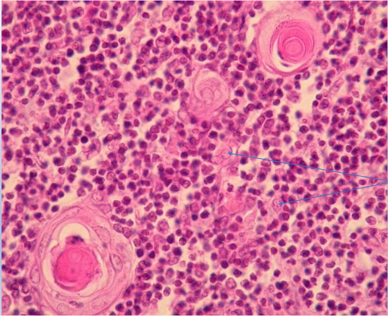<p>thymus </p>