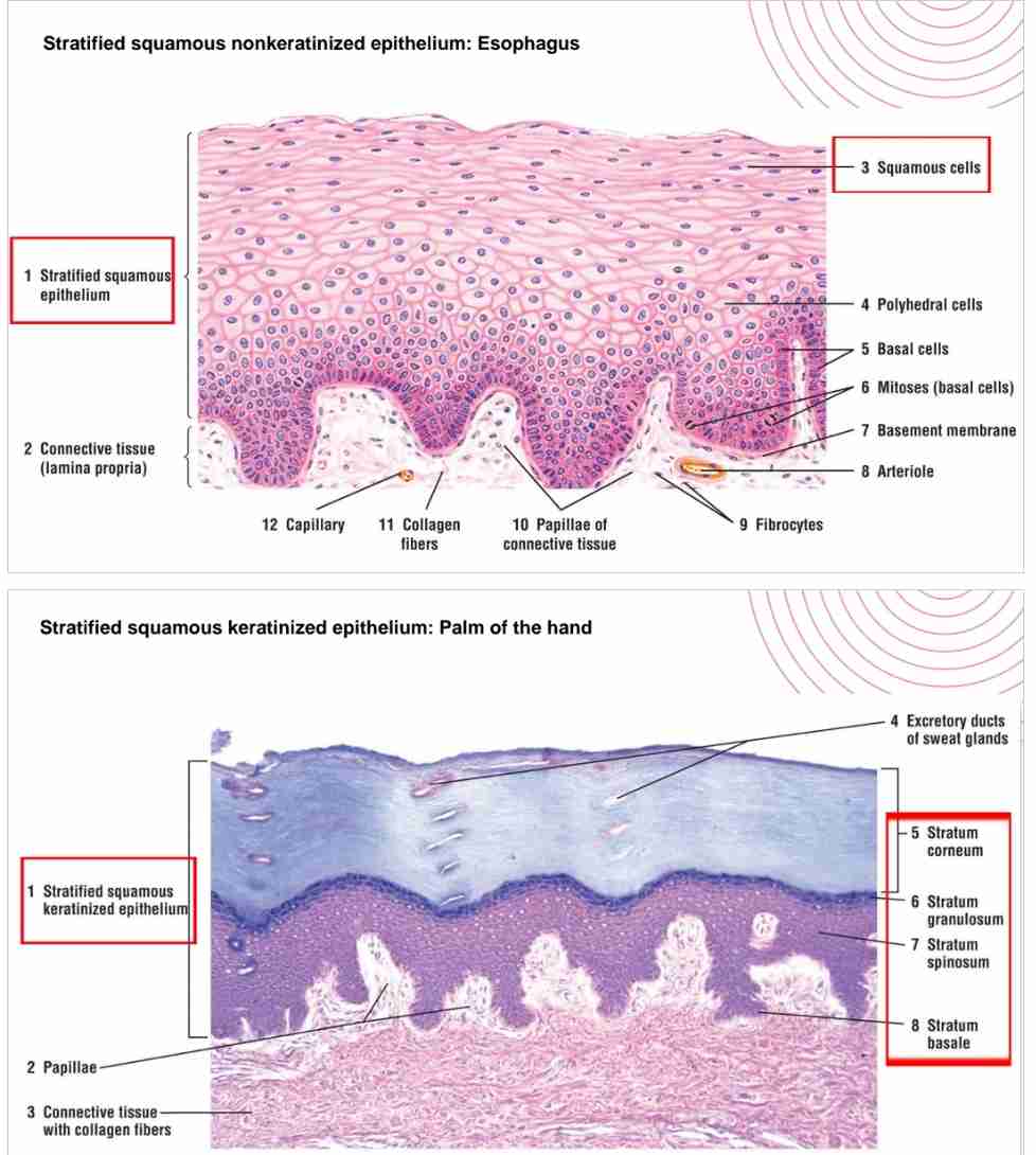 <p>Keratinized epithelium has dead, keratin-filled surface cells (e.g., skin), while non-keratinized covers moist cavities (e.g., mouth, vagina).</p>