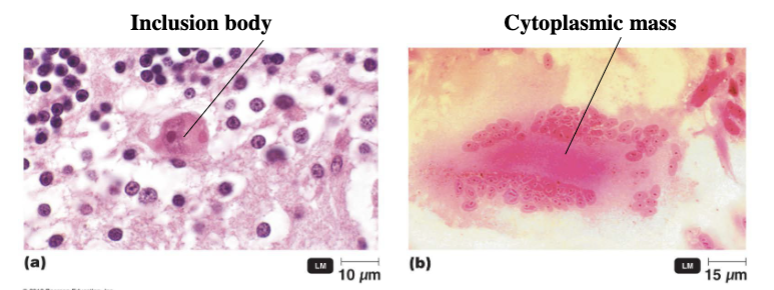 <p>Some effects that viral infection has on the host cells are very specific to the infecting virus</p><ul><li><p><span>﻿﻿Arrest of cell cycle</span></p></li><li><p><span>﻿﻿Formation of inclusion bodies</span></p></li><li><p><span>﻿﻿Formation of syncytium-fused cells (fused cells)</span></p></li></ul><p></p>