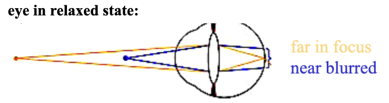 <p><span style="background-color: transparent; font-family: &quot;Times New Roman&quot;, serif;"><span>the process by which the eye changes its focus by </span><strong><u><span>changing the shape of the lens</span></u></strong></span></p><ul><li><p><span style="background-color: transparent; font-family: &quot;Times New Roman&quot;, serif;"><span>Done through contraction of ciliary muscle (attached to lens)</span></span></p></li><li><p><span style="background-color: transparent; font-family: &quot;Times New Roman&quot;, serif;"><span>When focus: Zonules of zinn RELAXED, ciliary muscle contracted, accommodated lens</span></span></p></li><li><p><span style="background-color: transparent; font-family: &quot;Times New Roman&quot;, serif;"><span>a fatter lens increases the optical power of the eye to bring images of near objects into focus&nbsp;</span></span></p></li><li><p><span style="background-color: transparent; font-family: &quot;Times New Roman&quot;, serif;"><span>in a camera the lens is moved closer or farther from the film/sensors to change the focus</span></span></p></li></ul><p></p>