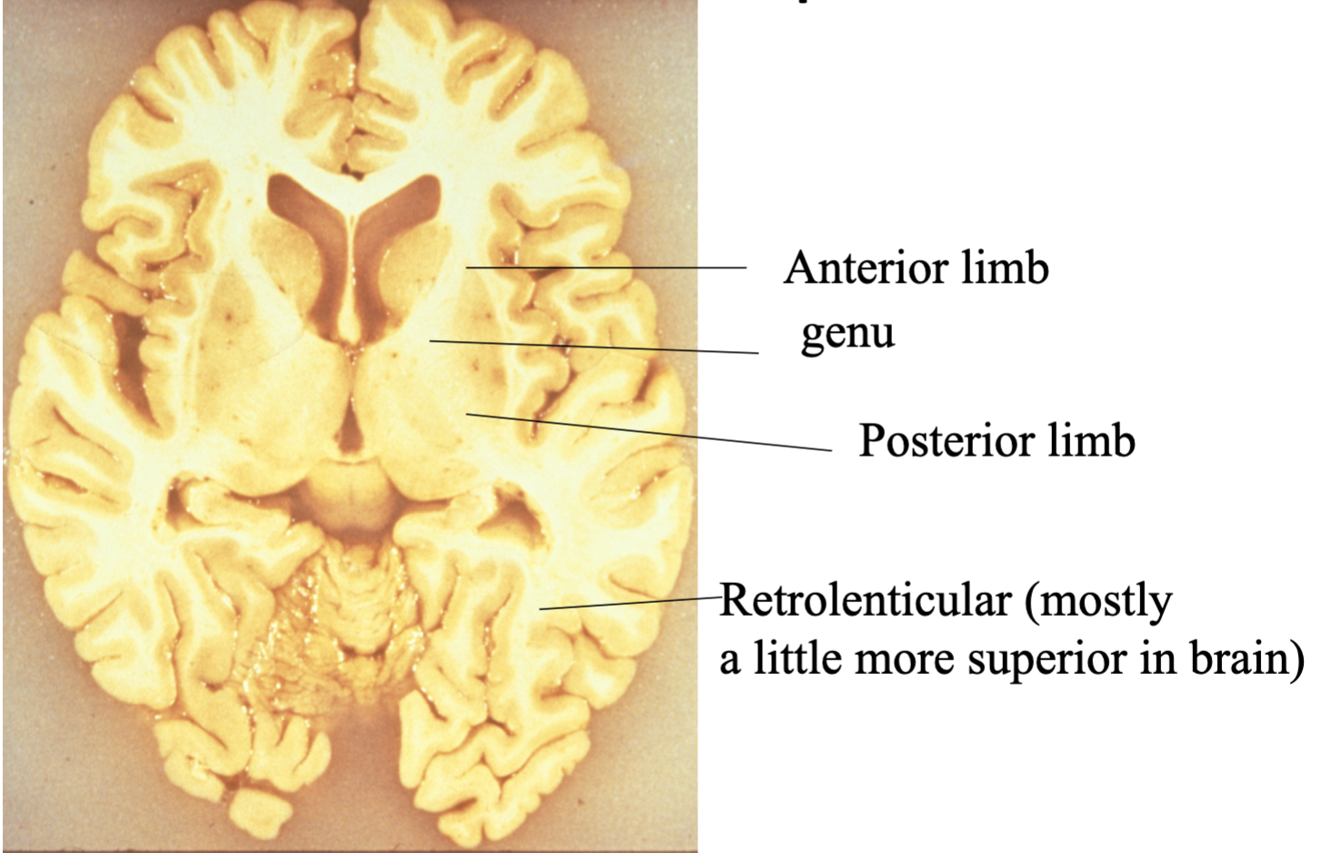 <ul><li><p>Are projection fibers that physically encapsulate the thalamus.</p></li><li><p>These are projections to and from cortical and subcortical structures</p></li></ul><p></p>