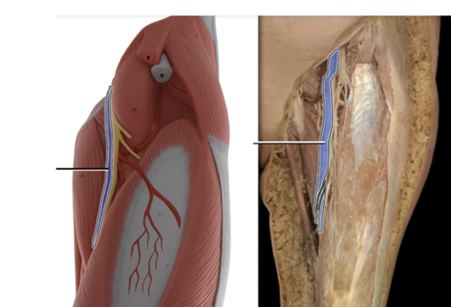 <p>Supplies blood to the lower abdominal wall, external genitalia, and lower limb</p>