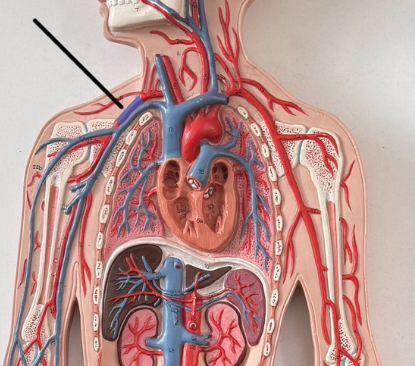 <p>What is this artery?</p>