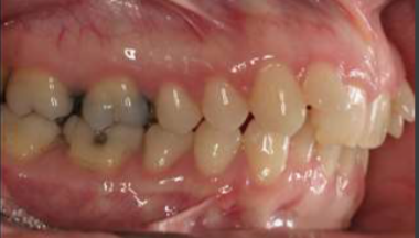 <p>classification?</p>