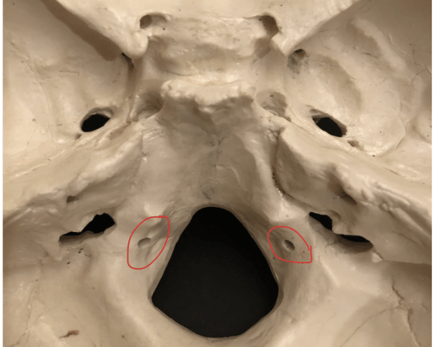 <p>Structure inside foramen magnum</p>