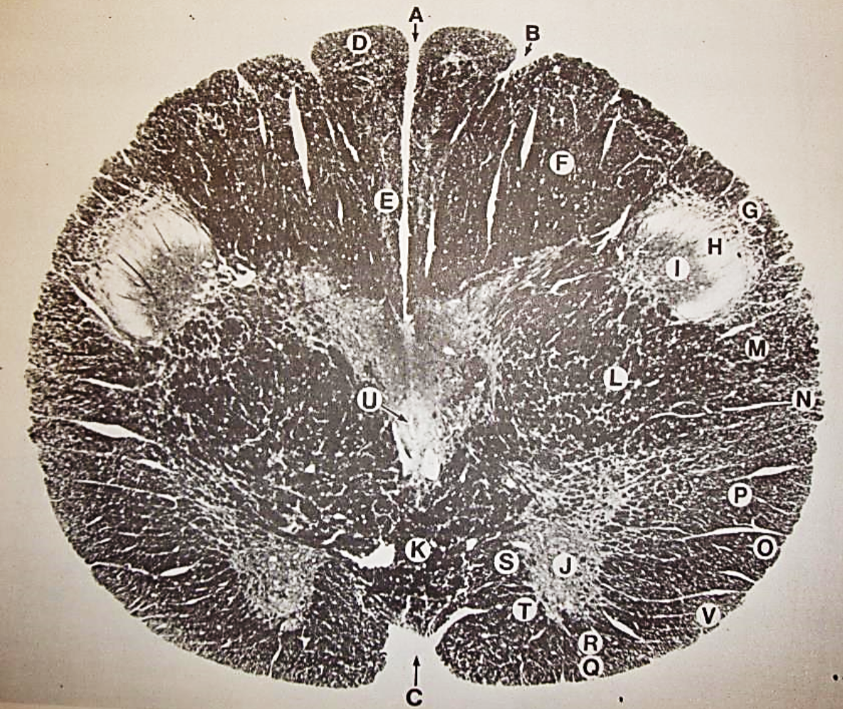 <p>G</p>