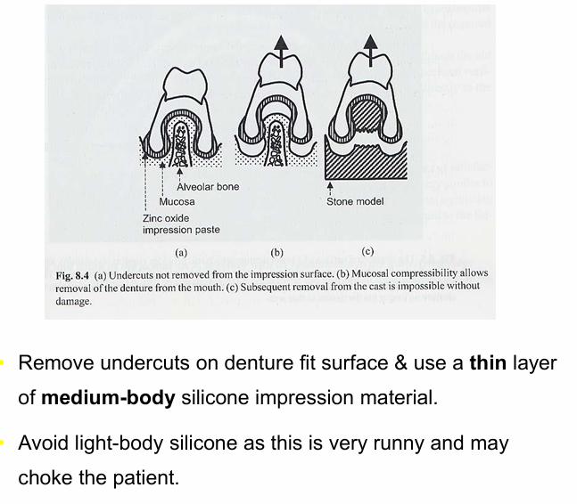 <p>remove undercuts and use a thin layer of medium-body silicone impression material&nbsp;</p>