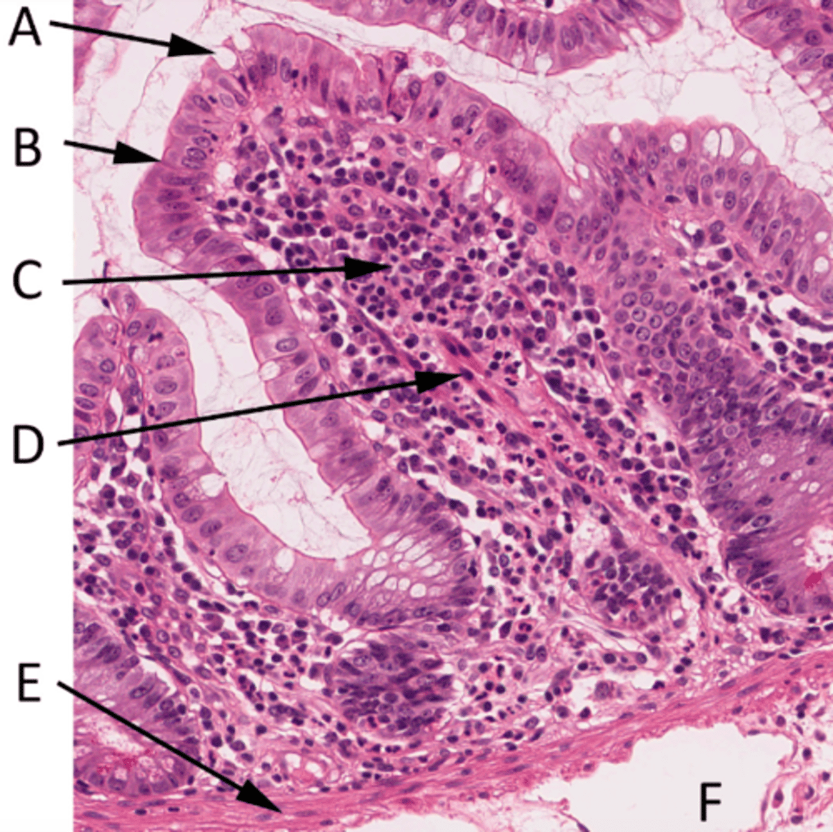 <p>A = Goblet cell</p><p>B = Enterocytes (simple columnar epithelium)</p><p>C = Lamina propria</p><p>D = Isolated smooth muscle fibres</p><p>E = Muscularis mucosa</p><p>F = Blood vessels in submucosa</p>