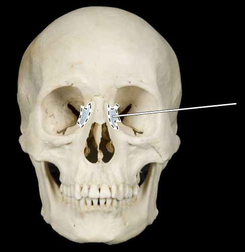 <p>Name this bone.</p><p>(Skull, anterior view).</p>