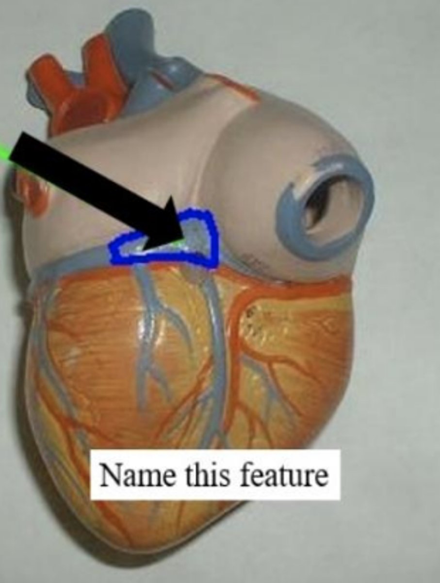 <p>What is the name of this feature?</p>