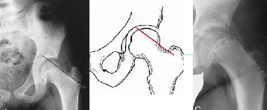 <p>Q what is the name of this measurement? and what is the average + range?</p>
