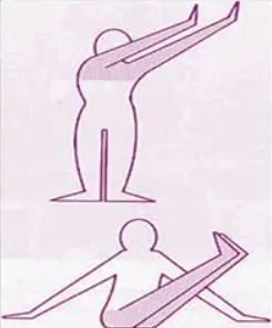 <p>What bilateral pattern is shown on the picture?</p>