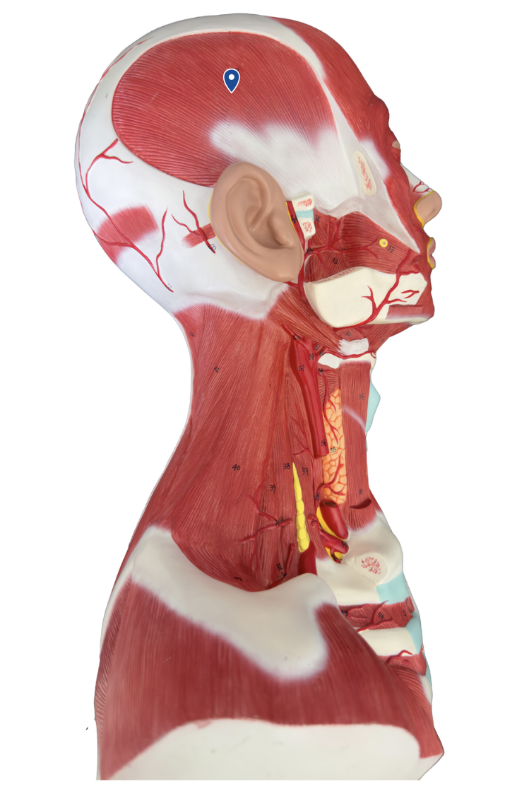 <p>What muscle is the arrow pointing to?</p>