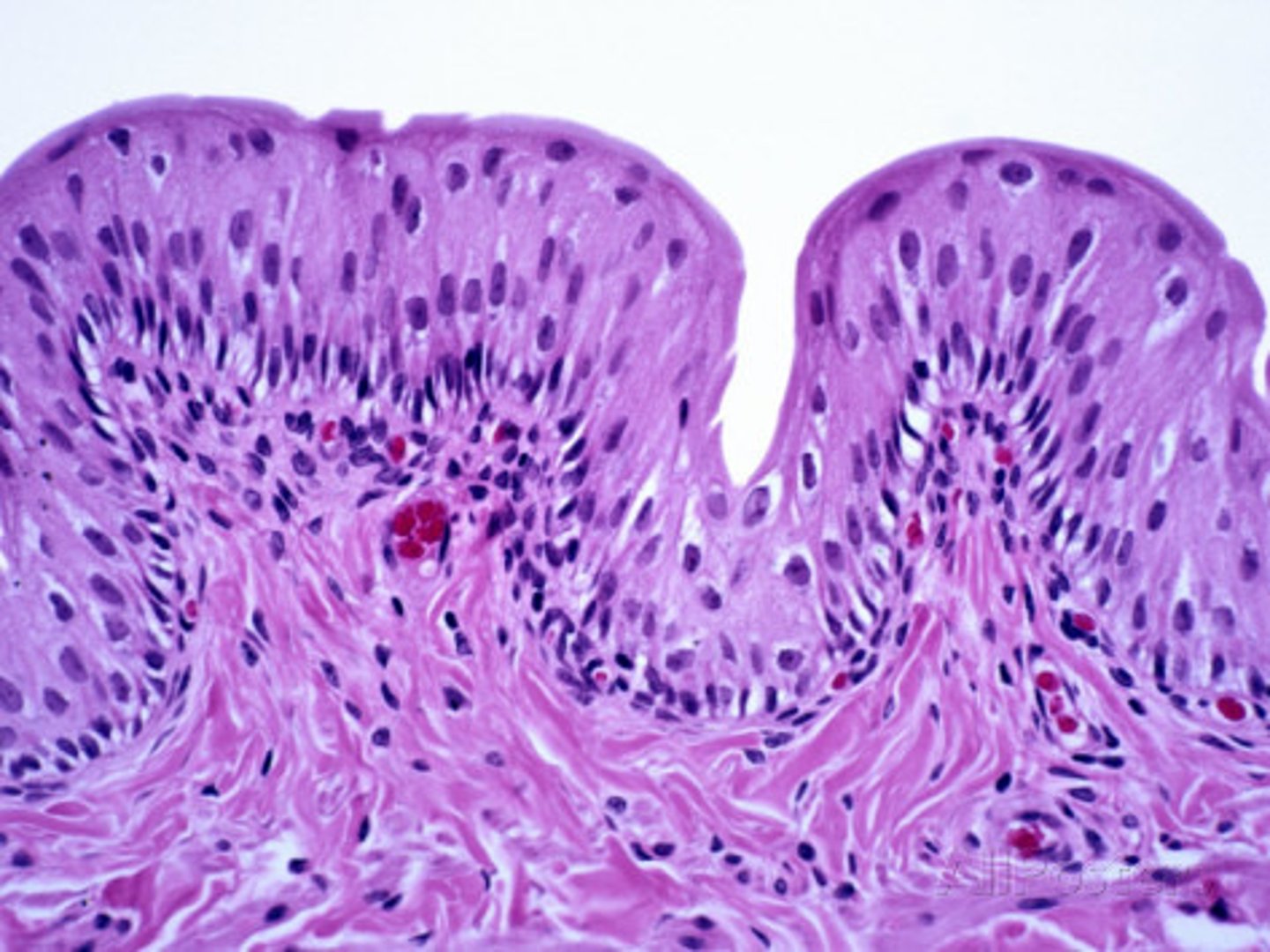 <p>name this, transitional epithelium</p>