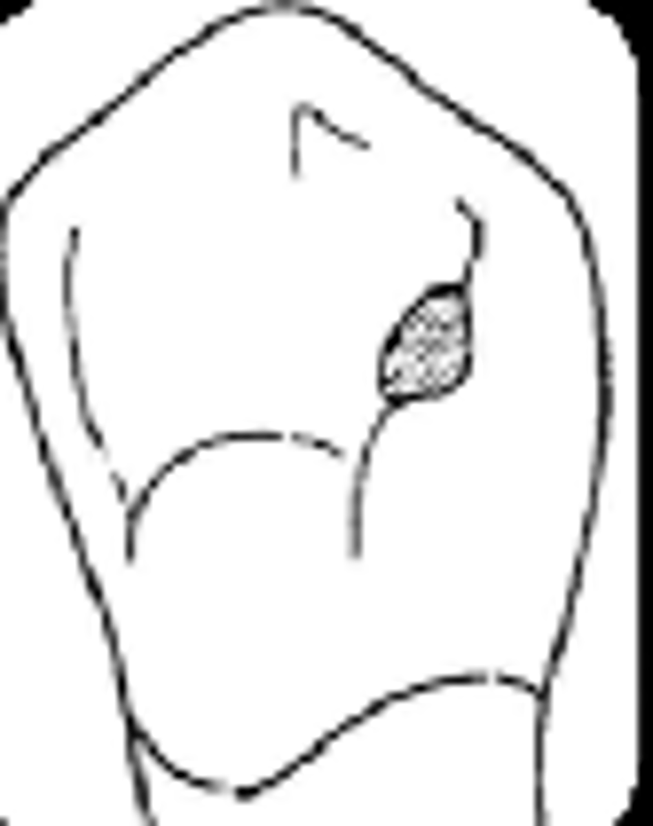 <p>Where should the small occlusal rest seat preparation for a ball or lug rest seat be made?</p>