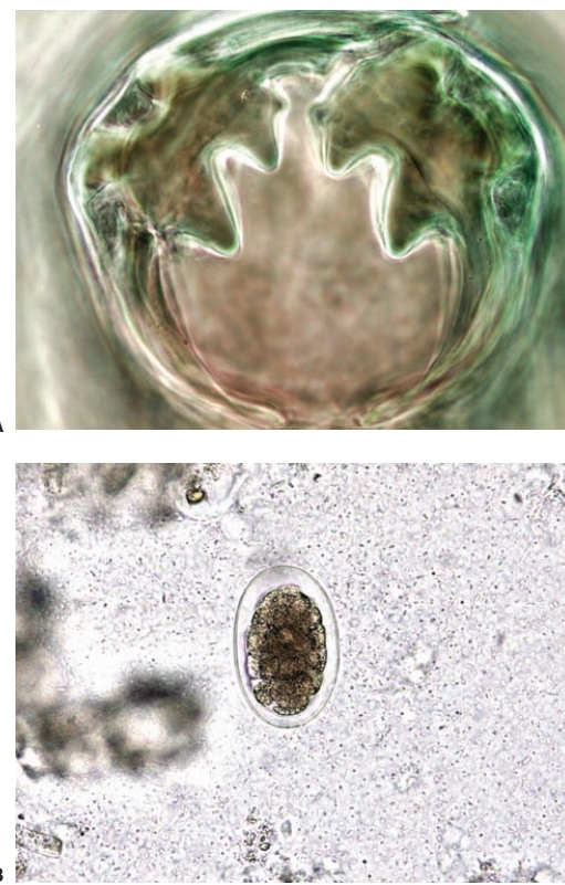 <p>Hookworm</p>