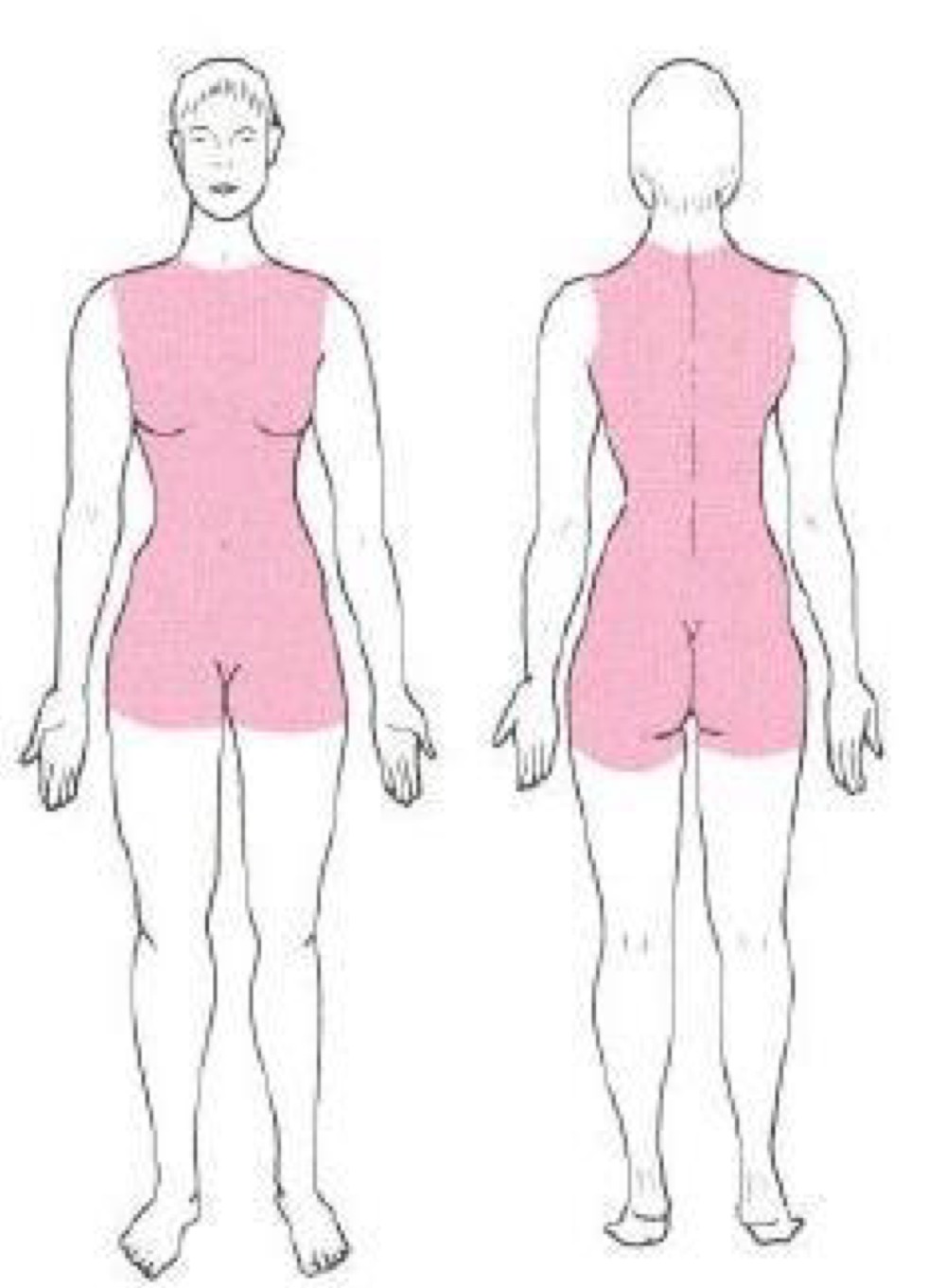 <p>what distribution of skin lesion is this </p>