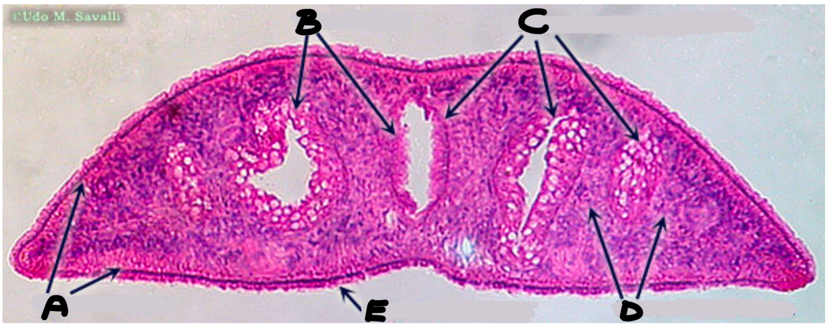 <p>What part of the planaria is labeled A</p>