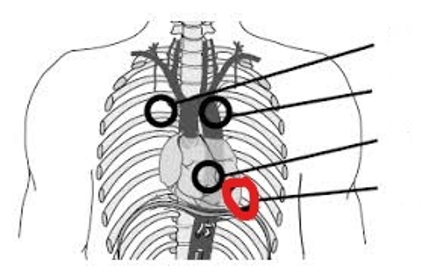 <p>5th intercostal space, medial to the midclavicular line. Apex of the heart</p>