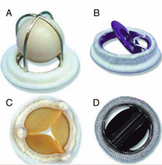 <p>what valves do these represent?</p>