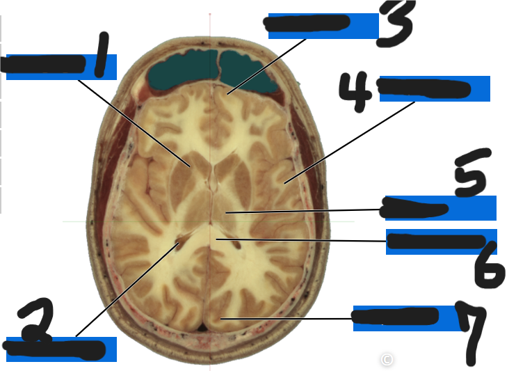 <p>what is number 1</p>