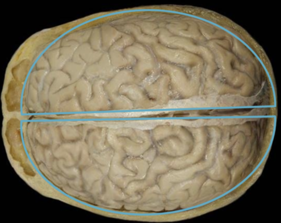 The "thinking parts" and the fiber tracts connecting those to each other and to brain-stem
