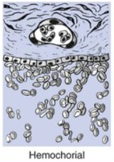 <p>Hemochorial placentation</p>