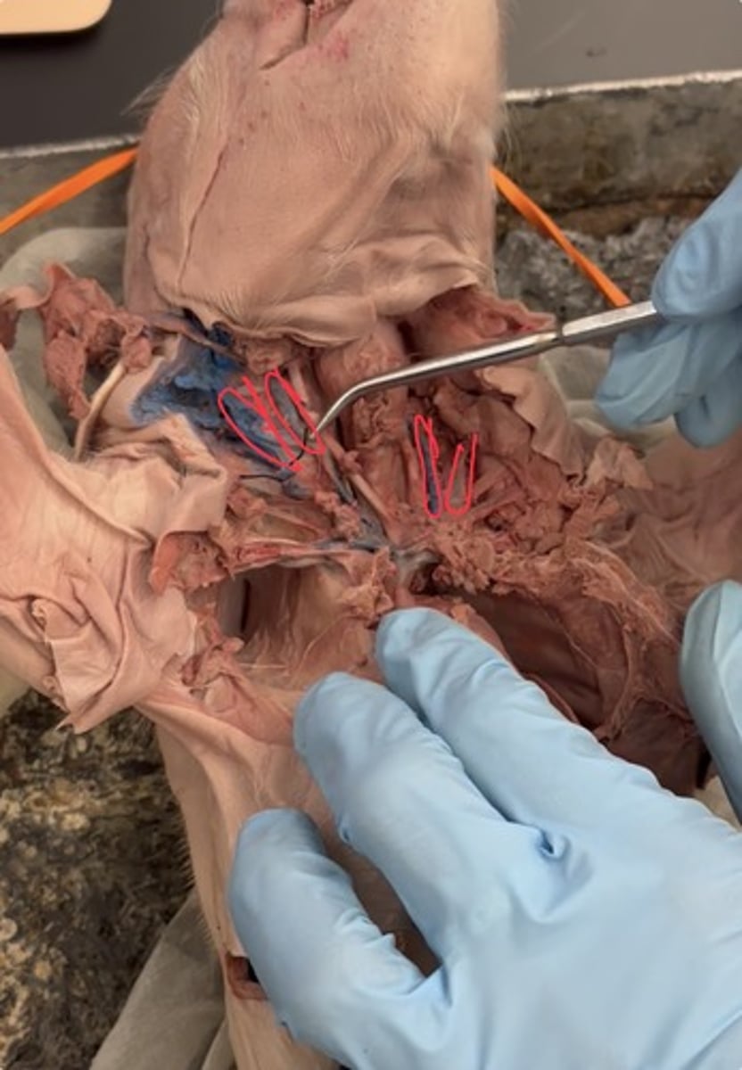 <p>int: brain ex: head &amp; face</p>